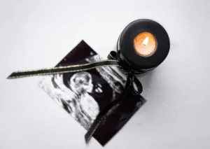 Nadciśnienie tętnicze w ciąży, rzucawka.